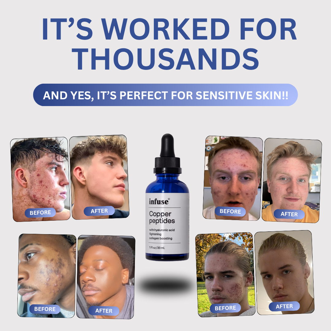 Copper Peptide Skin™ Serum