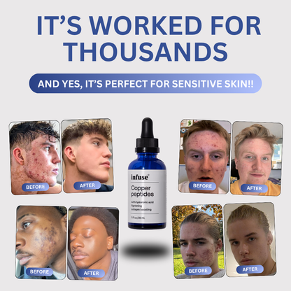 Copper Peptide Skin™ Serum