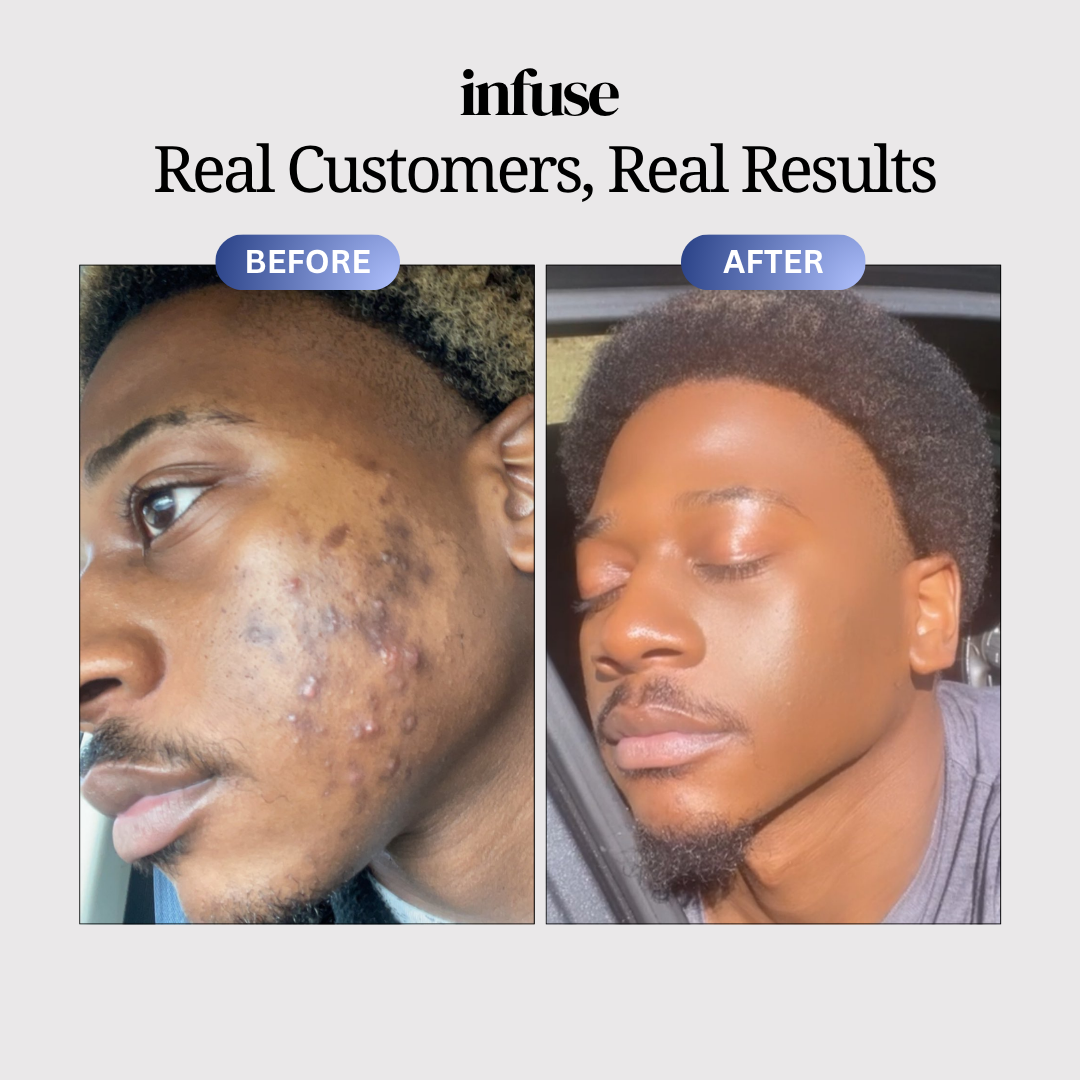 Copper Peptide Skin™ Serum